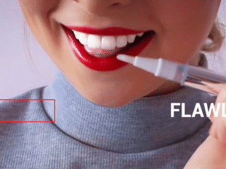 Teeth Whitening Gel